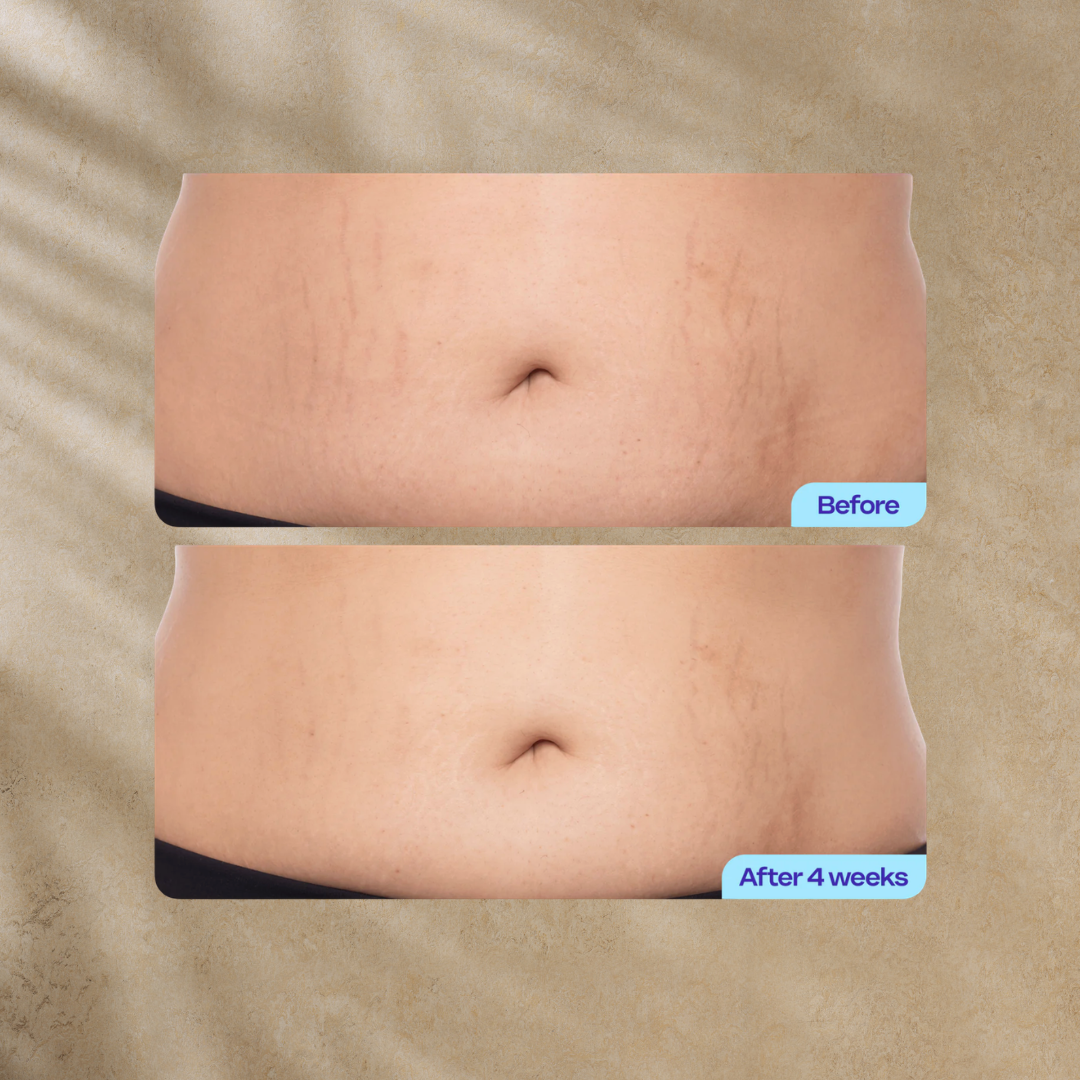 Tighten & Smooth Belly Cream