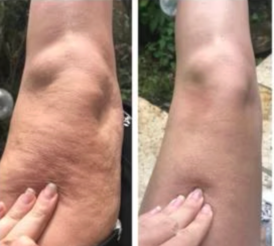 CRYO THERMO FIRMING GOLD