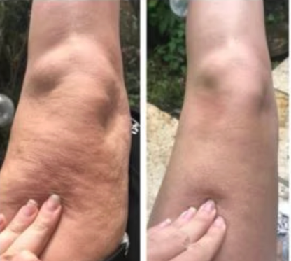 CRYO THERMO FIRMING GOLD