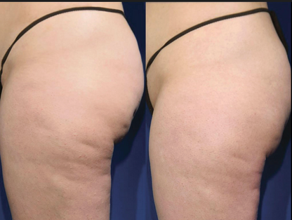 CRYO THERMO FIRMING GOLD