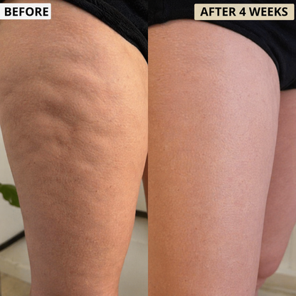 CRYO THERMO FIRMING GOLD