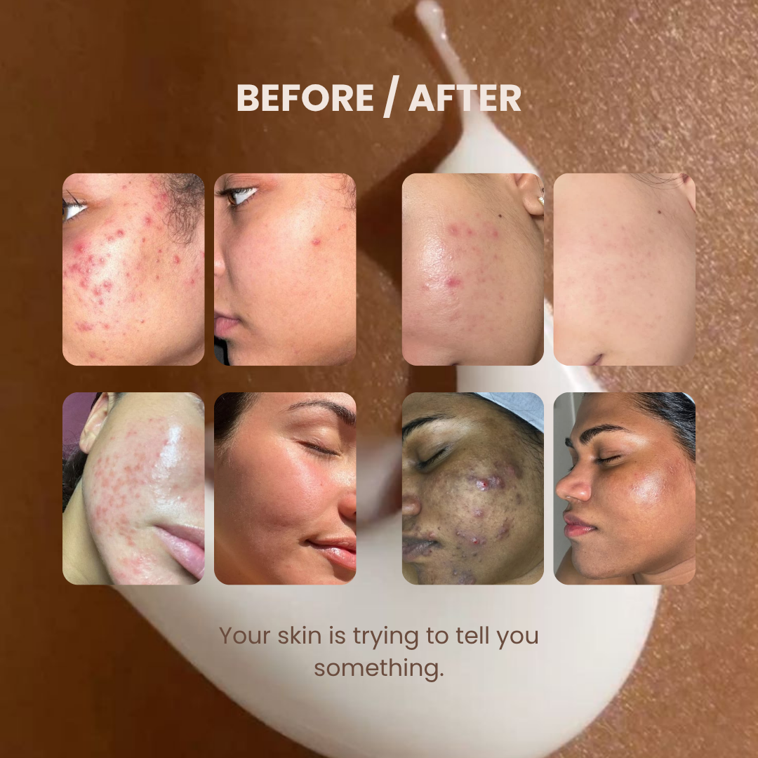 CICAEA™ Repair Cream