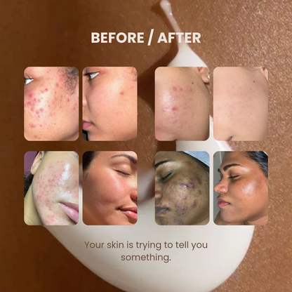 CICAEA™ Repair Cream