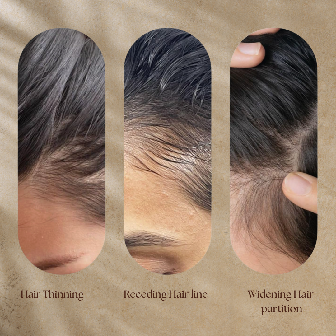 Rosemary Hair Growth Booster Serum